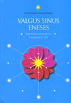 Valgus sinus eneses